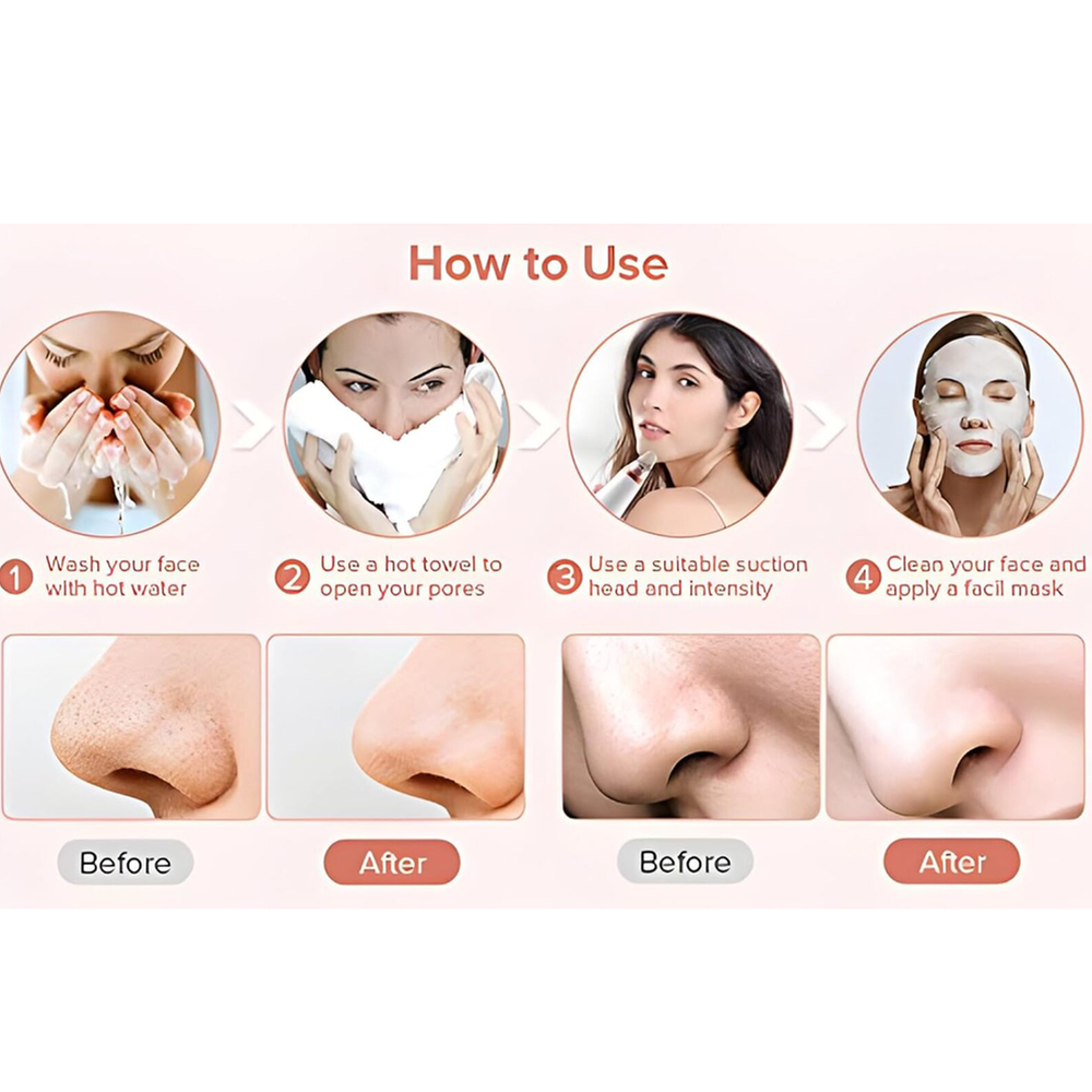 Rechargeable Blackhead Remover Vacuum - Image 2